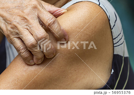 Senior Woman's right hand scratching her left arm, Blue swimming pool background, Close up shot, Asian Body skin part, Healthcare concept Senior Woman's right hand scratching her left arm, Blue swimming pool background, Close up shot, Asian Body skin part, Healthcare concept 56955376