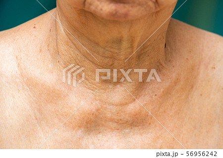 Senior woman's wrinkled neck, Close up, Blue swimming pool background, Body concept 56956242