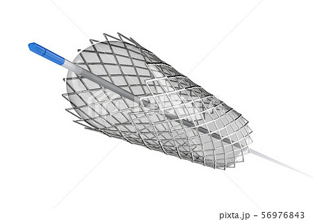 Stent for balloon angioplasty Stent for balloon angioplasty 56976843