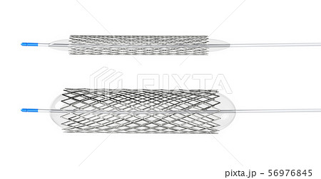 Stent for balloon angioplasty 56976845