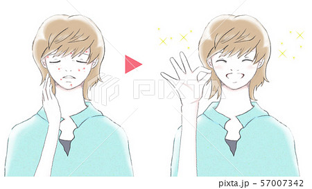 肌荒れに悩む女性と治った美肌の女性　ビフォーアフター 57007342
