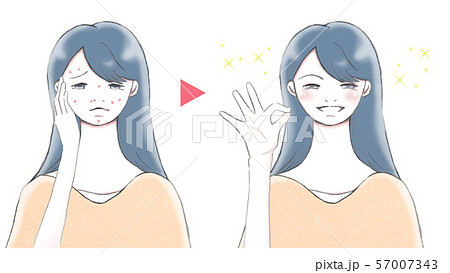 ニキビのある肌とニキビが治った肌 笑顔の女性のイラスト素材