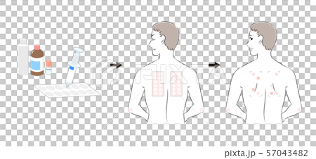 貼片測試刺痛測試檢查程序男 57043482