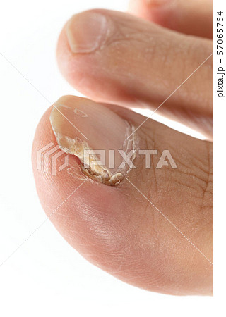 爪水虫 57065754