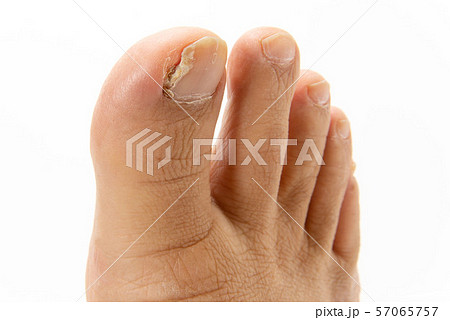 爪水虫 爪水虫 57065757