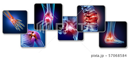 Pain Of The Joints Pain Of The Joints 57068584