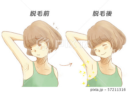 脱毛前と脱毛後の比較画像 57211316