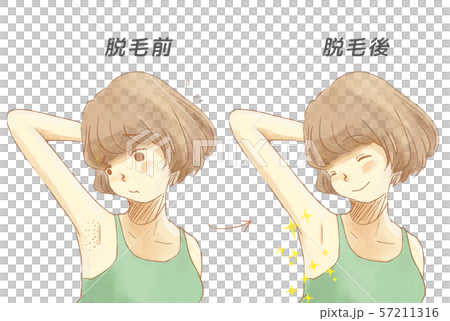 脱毛前と脱毛後の比較画像 57211316