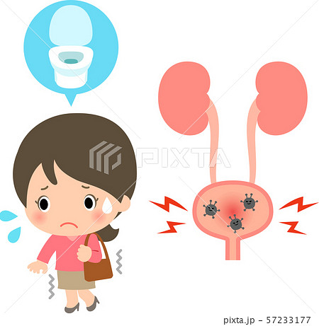 トイレに行きたい若い女性と膀胱炎のイメージのイラスト素材
