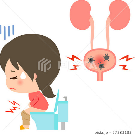 膀胱炎になった膀胱とトイレで苦しむ若い女性のイラスト素材