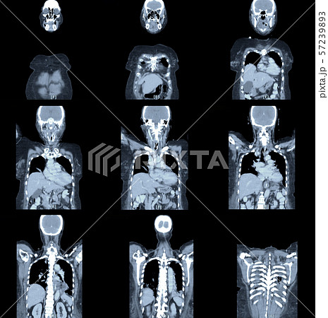 x-ray image mri scan 57239893