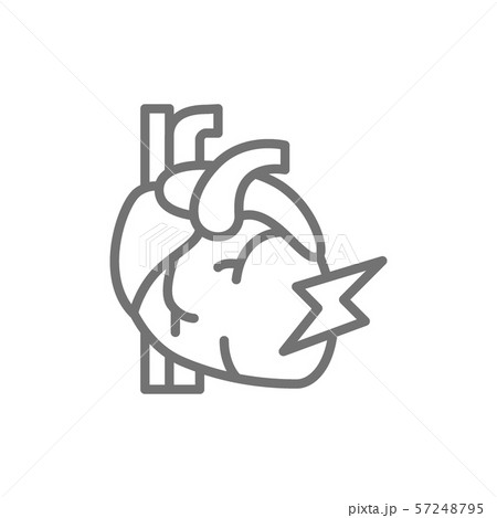 Vector heart attack, myocardial infarction line icon. Vector heart attack, myocardial infarction line icon. 57248795