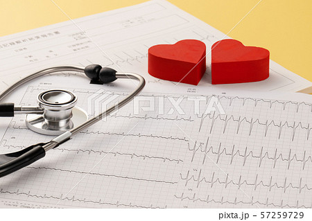 心電図　医療イメージ 57259729