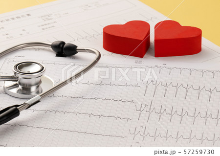 心電図　医療イメージ 57259730