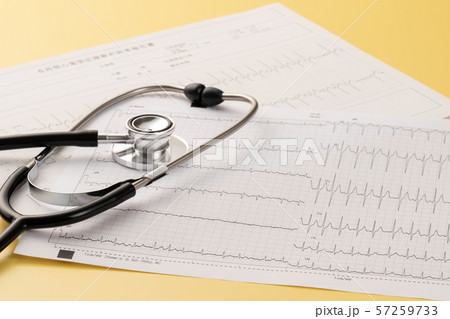 心電図　医療イメージ 57259733