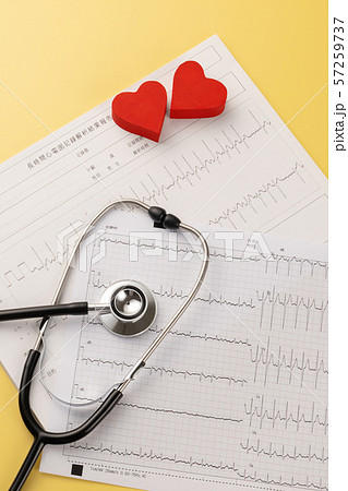 心電図　医療イメージ 57259737