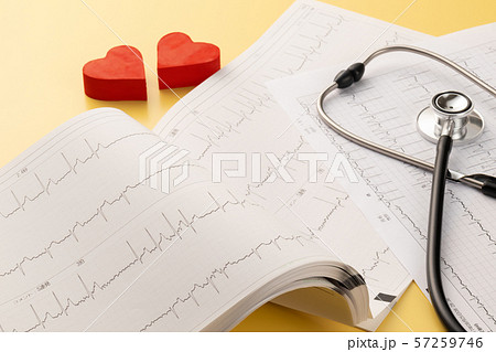 心電図 医療イメージ 心電図 医療イメージ 57259746