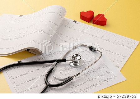 心電図　医療イメージ 57259755