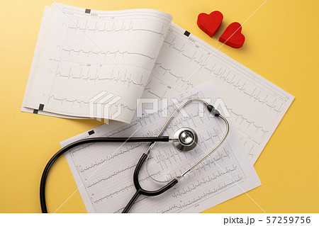 心電図　医療イメージ 57259756