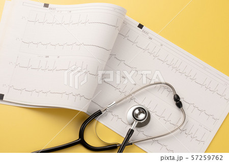 心電図 医療イメージ 心電図 医療イメージ 57259762