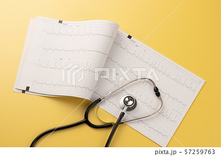 心電図　医療イメージ 57259763