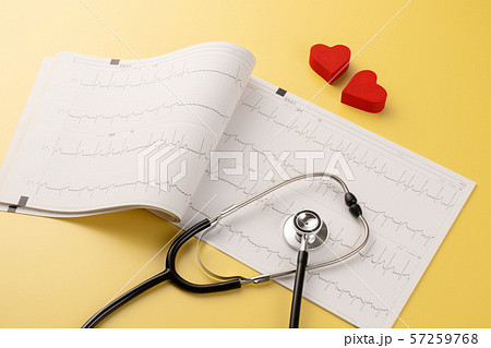 心電図　医療イメージ 57259768