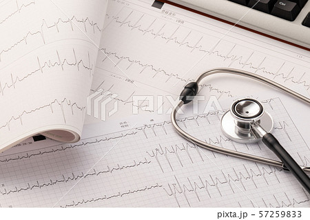 心電図 医療イメージ 心電図 医療イメージ 57259833