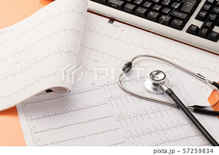 心電図　医療イメージ 57259834