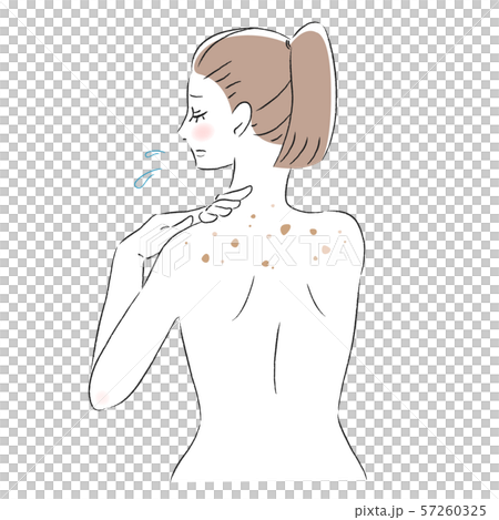 背中　肌　悩み　シミ　女性 57260325