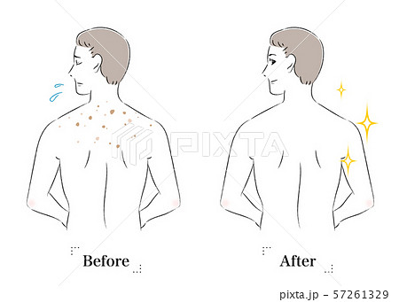 背中 肌 悩み シミ ビフォーアフター 男性のイラスト素材