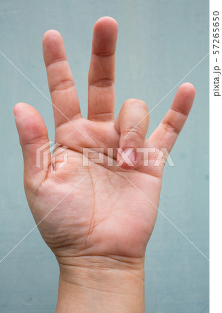 Trigger Finger lock on ring finger of woman's front left hand, Suffering from pain, On Blue-grey colour background, Close up & Macro shot, Office syndrome, Health care concept Trigger Finger lock on ring finger of woman's front left hand, Suffering from pain, On Blue-grey colour background, Close up & Macro shot, Office syndrome, Health care concept 57265650