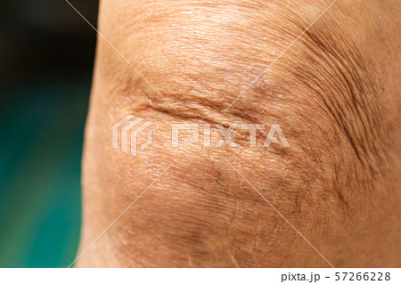 Senior woman's wrinkled knees in blue swimming pool Blurred and bokeh background, Close up & Macro shot, Selective focus, Body concept Senior woman's wrinkled knees in blue swimming pool Blurred and bokeh background, Close up & Macro shot, Selective focus, Body concept 57266228