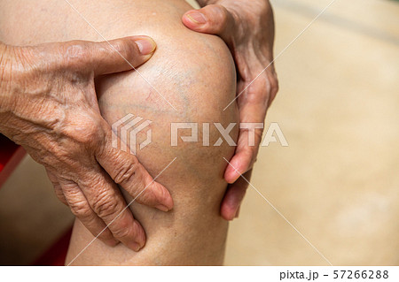 Senior woman suffering from knee pain sitting on chair, Massaging by her hand, Close up, Body concept 57266288
