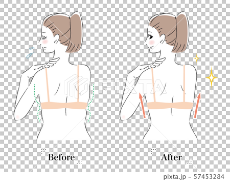 背中 はみ肉 脂肪 ビフォーアフター 女性 背中 はみ肉 脂肪 ビフォーアフター 女性 57453284