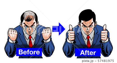 ビフォーアフター スーツ　バーコード ハゲ　グッジョブ  57481975