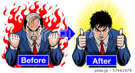 ビフォーアフター スーツ　バーコード ハゲ　グッジョブ  57481978