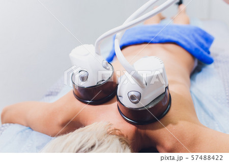 Cropped view of cosmetologist with roller doing buttocks starvac massage. 57488422