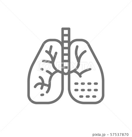 Lung disease line icon. Isolated on white background 57537870