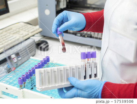 doctor hand taking a blood sample tube from a rack doctor hand taking a blood sample tube from a rack 57539506
