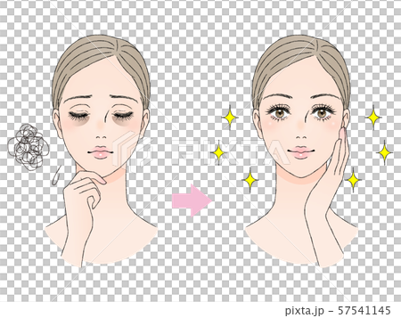 Beauty image Bear under eyes 57541145