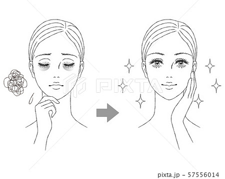 美容イメージ　目の下のクマ 57556014