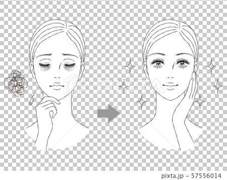美容イメージ　目の下のクマ 57556014