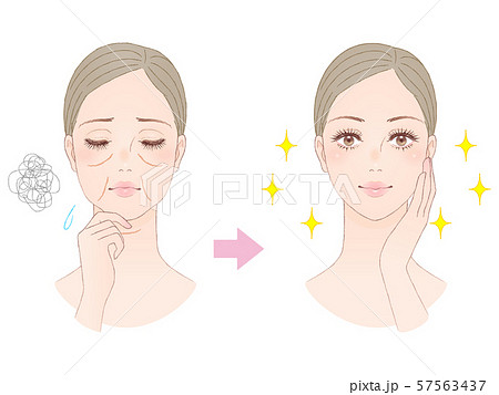 美容イメージ たるみ 美容イメージ たるみ 57563437