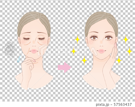 美容イメージ たるみ 美容イメージ たるみ 57563437