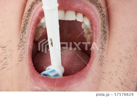 Cleaning bottom teeth 57576629