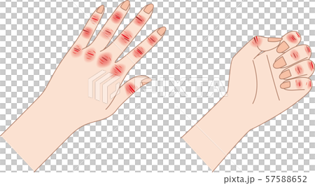 在第一章 57588652