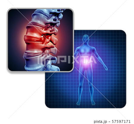 Human Back Joint Pain 57597171