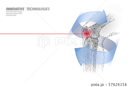 Human knee joint 3d model vector illustration. Low poly design future technology cure pain treatment 57626158