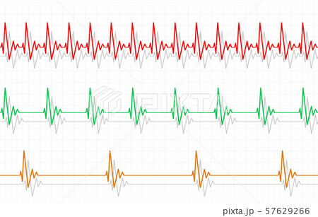 Fast Normal Slow Pulse 57629266