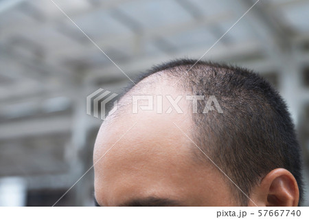 Close up young man concerned Close up young man concerned 57667740